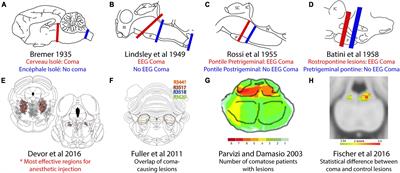 A Century Searching for the Neurons Necessary for Wakefulness